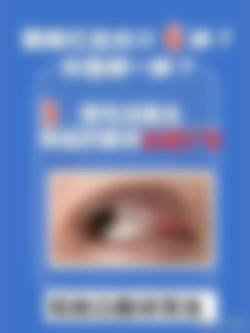 常见问题解答