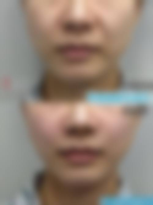 FAQ:常见问题解答