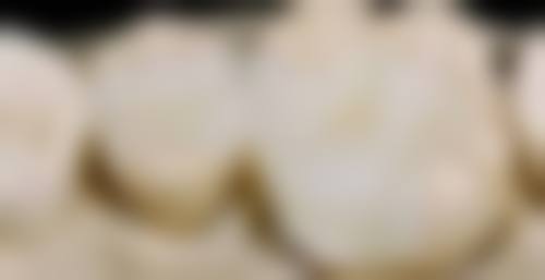 核心项目优势解析,满足多样化口腔需求