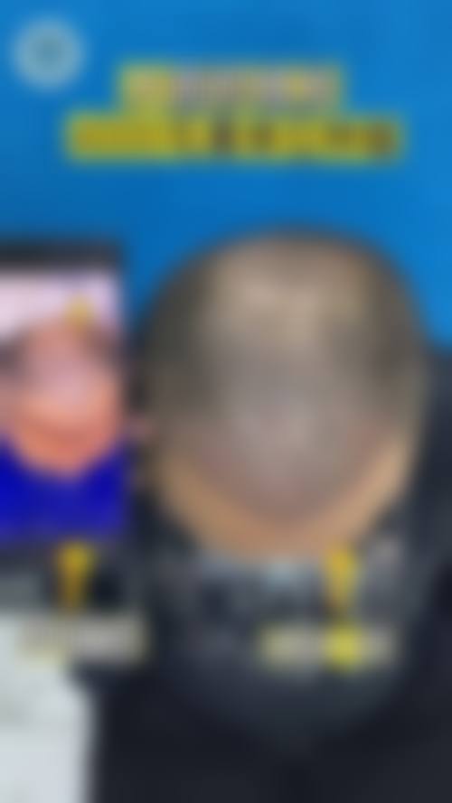 透明收费与优惠活动详情
