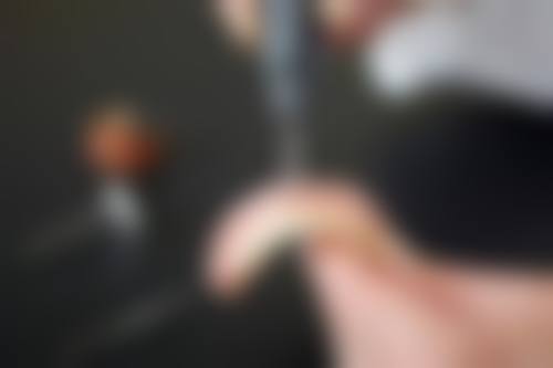 擅长项目详解:精细匹配您的口腔需求
