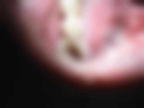 预约优惠活动