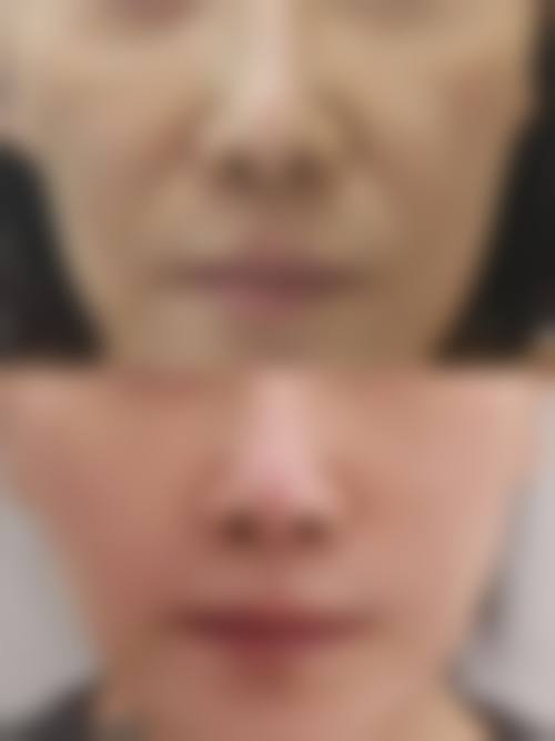 临床实例分享