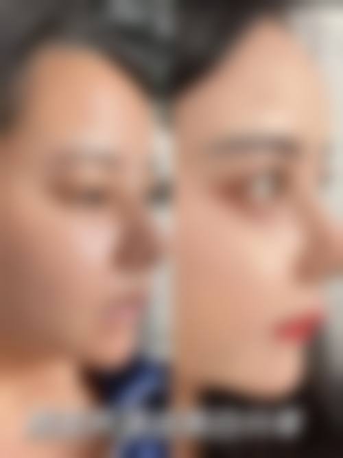预约优惠活动:限时补贴不容错过