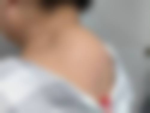 患者真实评价:天津缪慈医疗美容门诊部徐正一