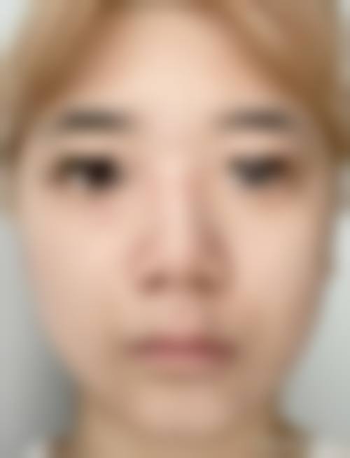预约优惠活动:天津缪慈医疗美容门诊部徐正一
