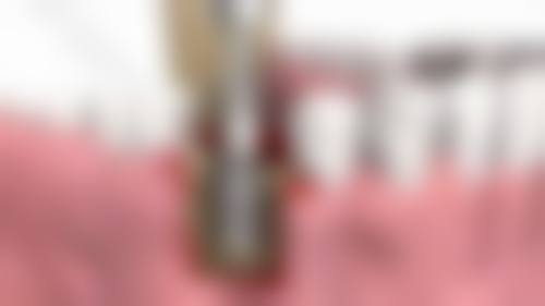 结尾预约号召:南昌唯乐口腔(红谷滩万达分院)熊梦琴医生值得信赖