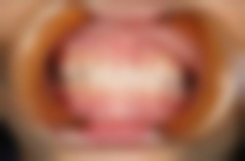 七、重庆云阳六个牙口腔就医指南,便捷就诊不迷路