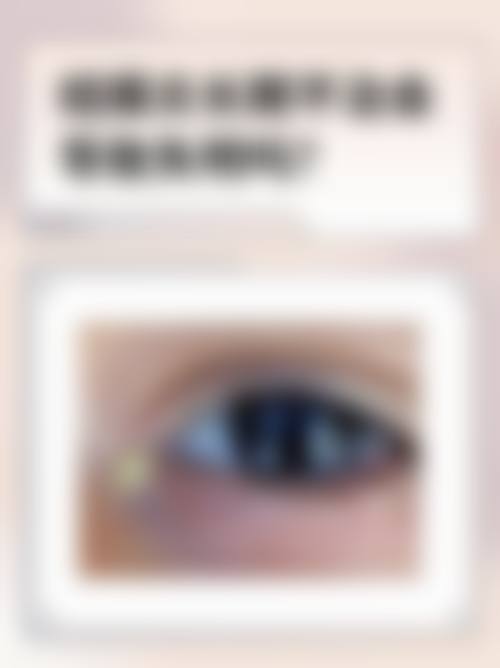 常见问题解答