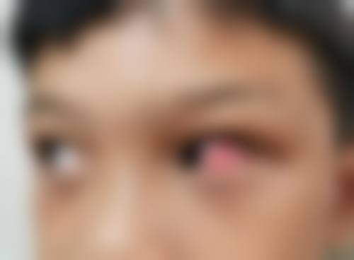 预约优惠活动苏州大学附属第二医院眼科