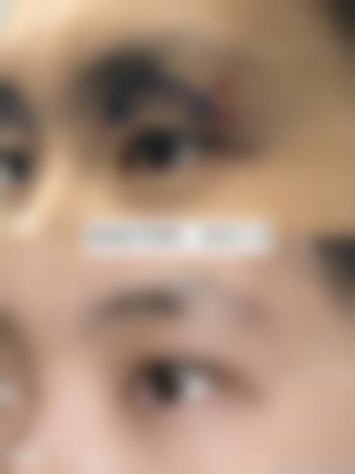 FAQ:天津缪慈医疗美容门诊部徐正一