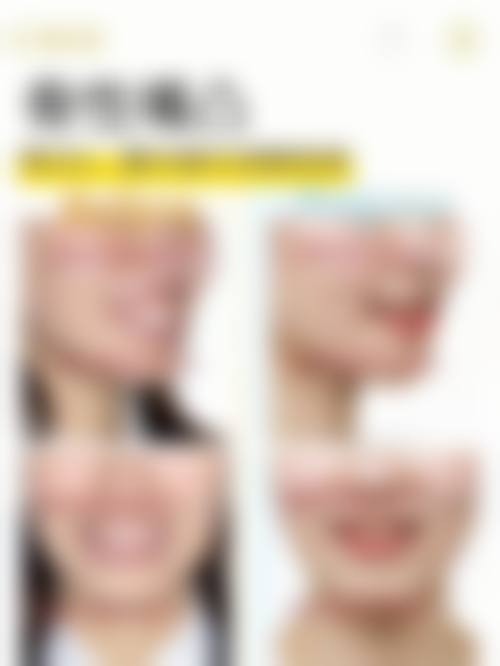 擅长项目详解：上海沐良诚口腔·矫正种植联合中 心王中亮