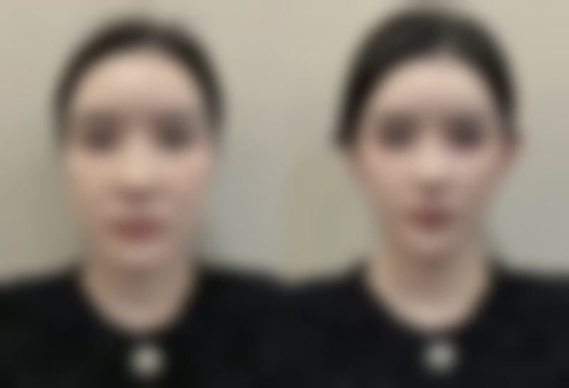透明价格体系，享超值优惠助力美丽升级