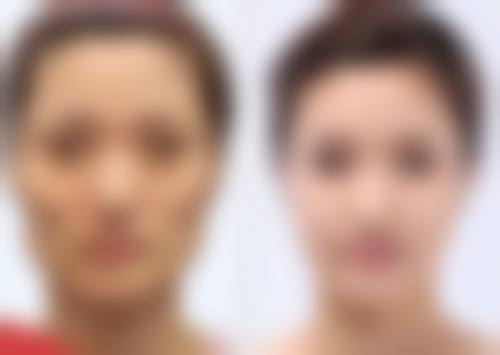 透明合理定价,高性价比开启年轻态