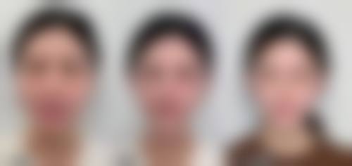 医生资质介绍:广州澳玛星光医疗美容诊所刘慧洁