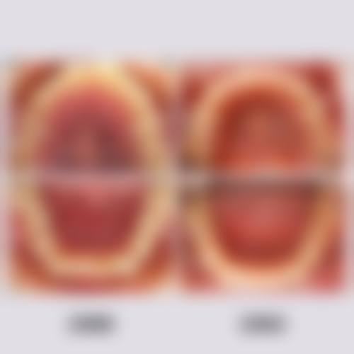临床实例分享
