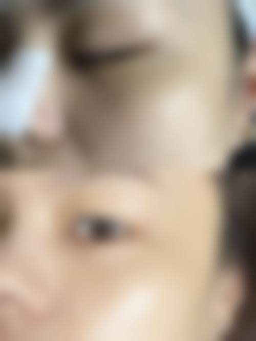 预约优惠活动:广州澳玛星光医疗美容诊所刘慧洁