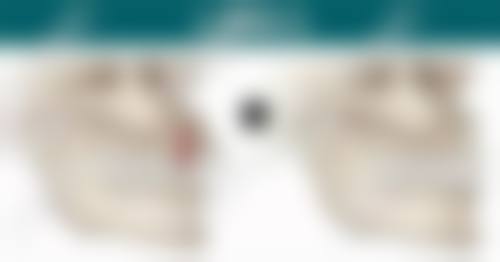 FAQ:常见问题解答