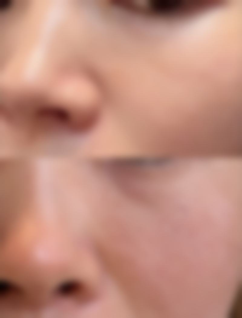 即刻行动,获取您的专属变得更美方案
