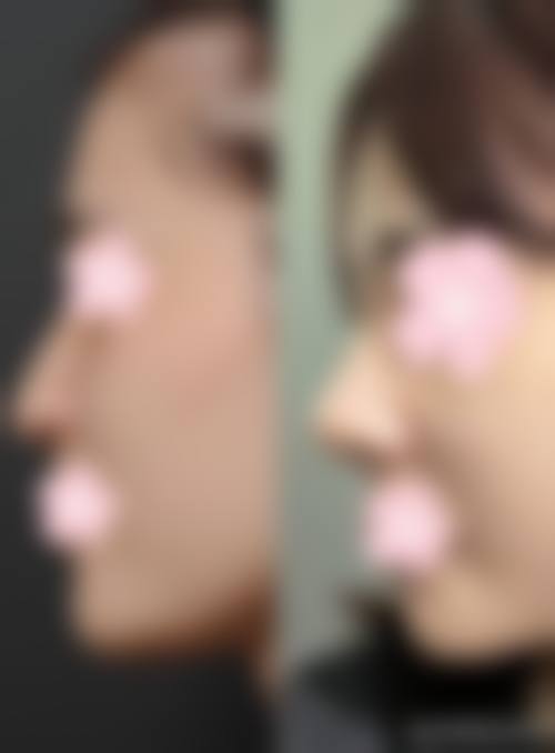 预约优惠活动:专属补贴助力变得更美