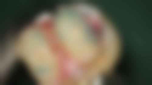 患者真实评价:北京极简一站式魏公村口腔关中山就医反馈