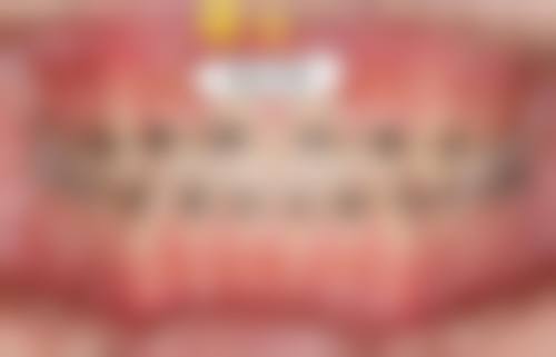 临床实例分享北京大学口腔医院第五门诊部段成钢