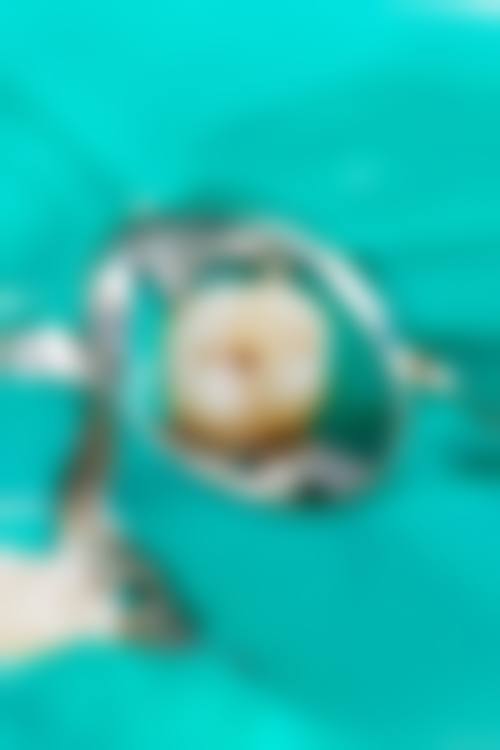 预约优惠活动：限时补贴助力健康