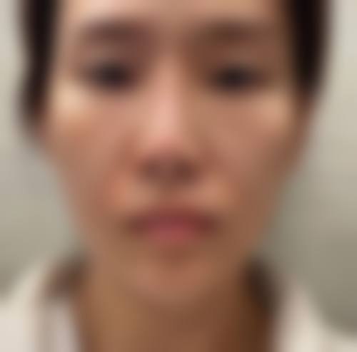 擅长项目详解
