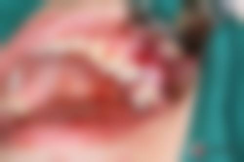 结尾预约号召:立即行动,重拾口腔健康