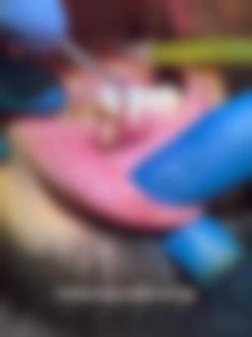 诊疗特色总结:北京皓尔佳艺口腔门诊部朱骏飞