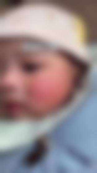 擅长项目详解:吕旭东医生擅长做我需要的项目吗?