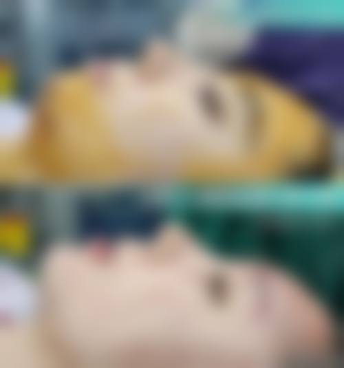患者真实评价:宋美佳+核心项目