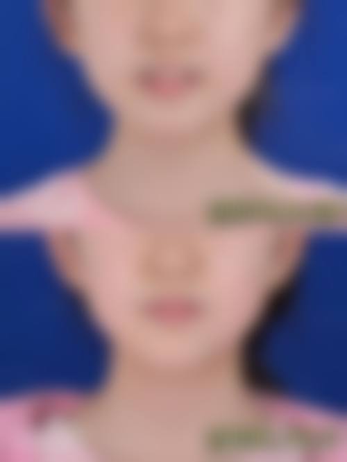预约优惠活动