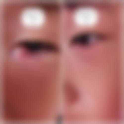 核心科室与特色项目解析:从白内障到近视矫正