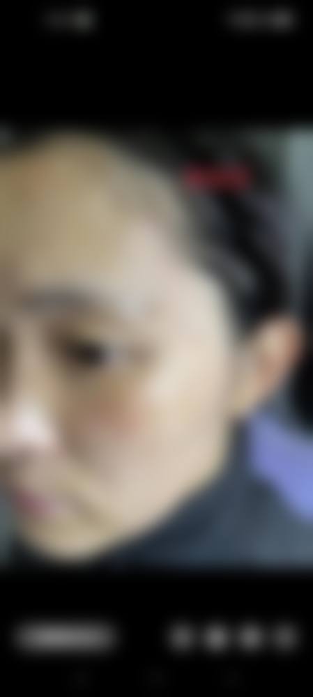 精良设备引进与特色医美项目解析