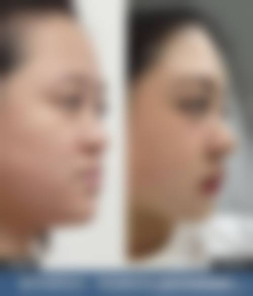 预约优惠活动