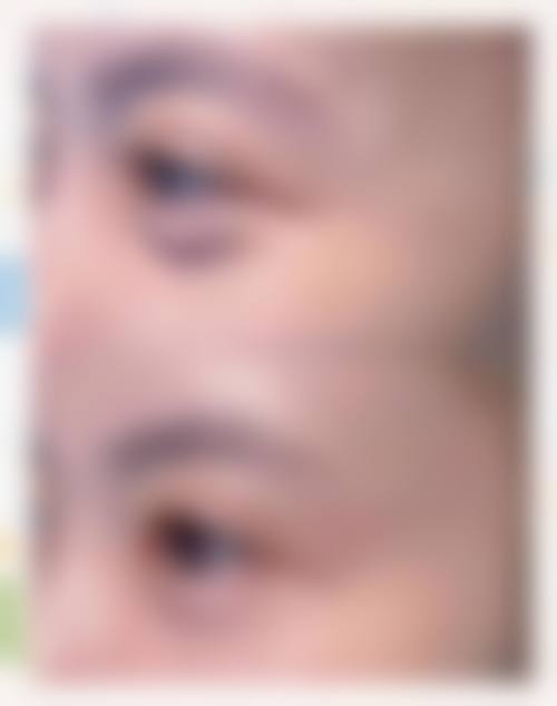 临床实例分享