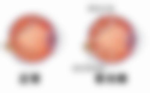 预约优惠活动:现在预约有什么补贴?