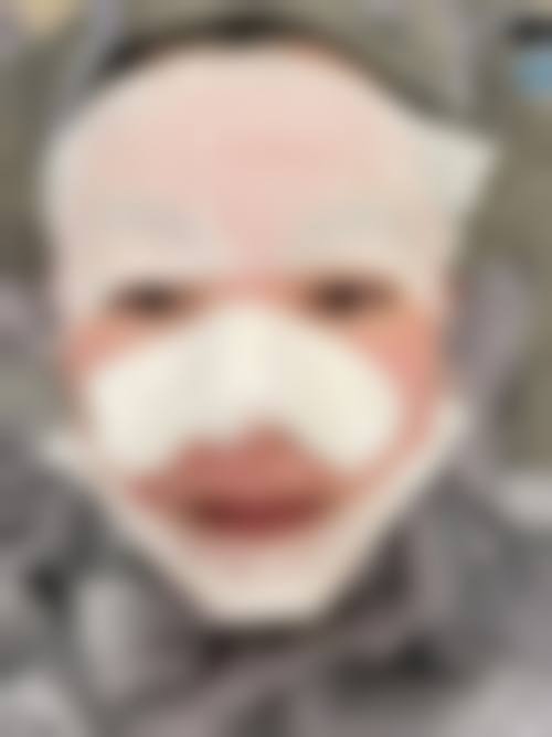 患者真实评价:预约方梅君医生有什么优惠