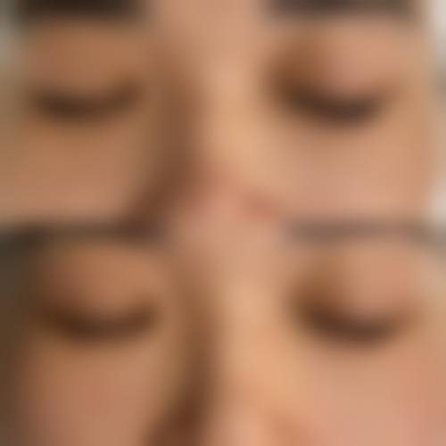 擅长项目详解:方梅君+深圳新兴皮肤病专科整形门诊部+核心项目