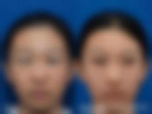 擅长项目详解:周秋根擅长做我需要的项目吗?