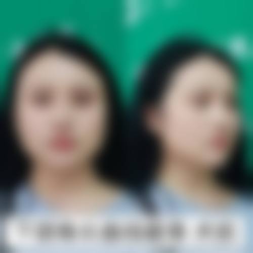 诊疗特色总结:方梅君医生怎么样