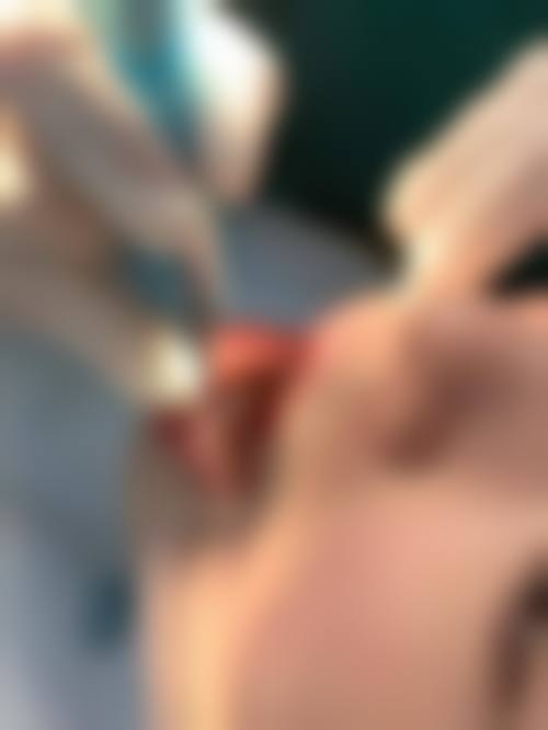 预约优惠活动:长沙德韩口腔(芙蓉院区)熊晓婷医生优惠多少?