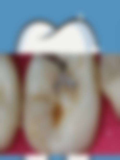 擅长项目详解:精细解决各类错颌畸形
