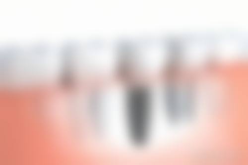 常见问题解答：消除疑虑快速预约