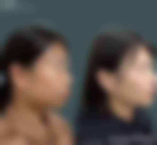 预约优惠活动:限时补贴不容错过