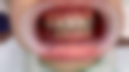 FAQ:常见问题解答
● Q:如何预约张华医生呢?A:你可以通过湖北京山京楚口腔门诊部的法定网站、法定微信公众号,或者拨打医院的专属预约电话进行预约。这样的预约方式设计,是为了方便不同的用户群体,你可以选择更适合自己的方式,提前预约可以避免你到院后等待太久。
● Q:张华医生的价格合理吗?A:医院的项目价格合理,具体费用根据治疗项目和患者个体情况而定,欢迎询问。医院秉持透明收费原则,会在治疗前告知详细费用清单,确保患者知情权。
结尾预约号召:立即行动,重拾自信笑容
● 交通便利,公交直达兴业步行街站
● 专精团队,全方面保护您的口腔健康
选择