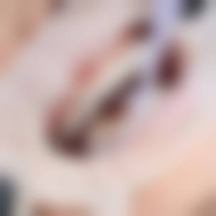 预约优惠活动