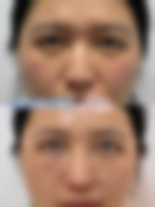 总结与预约号召