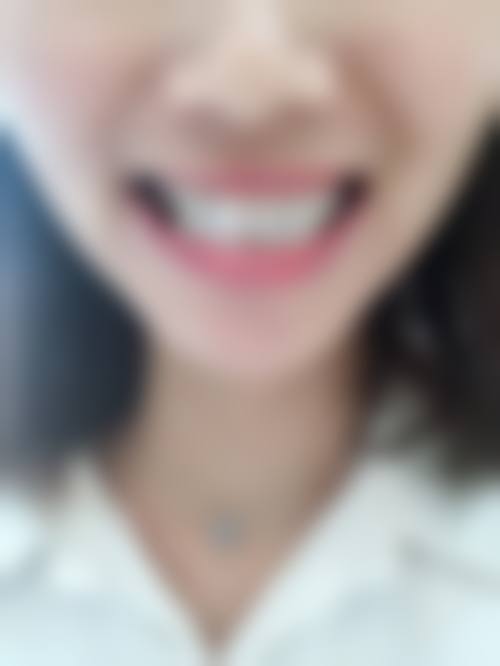 擅长项目详解:北京大学口腔医院第五门诊部张斐然